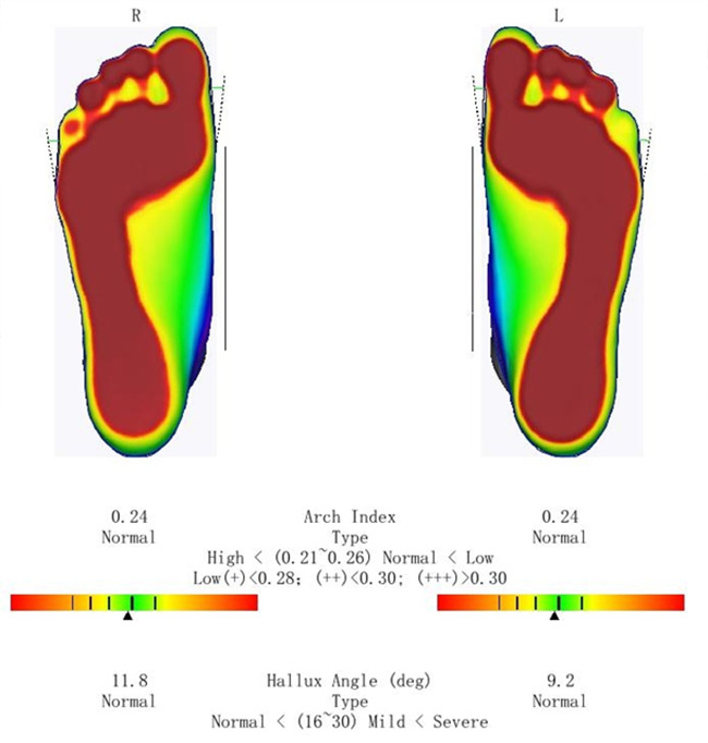 Обзор ортопедических 3D сканеров бренда ScanPod3D