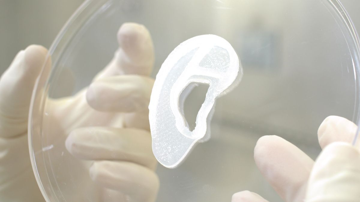 Первая успешная имплантация человеческого уха, напечатанного на 3D принтере, открывает новые горизонты в медицине