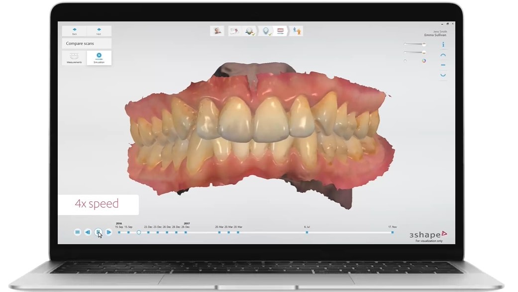 Scan 10. 3shape сканер. 3d сканер 3shape интраоральный. 3d Shape сканер стоматологический. Внутриротовой сканер 3shape.