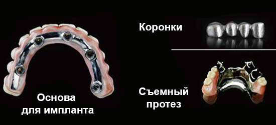 3D-принтер-Phrozen-FORGE-21.jpg